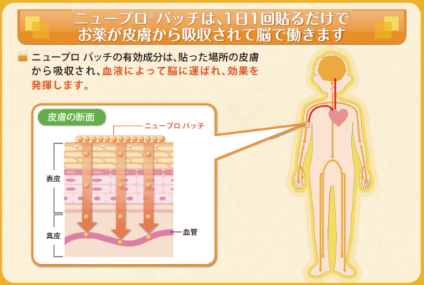 ニュープロパッチはパーキンソン病治療に使用する貼り薬 | ikpdi.com